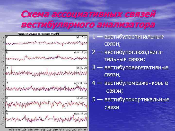 Схема ассоциативных связей вестибулярного анализатора 1 — вестибулоспинальные связи; 2 — вестибулоглазодвигательные связи; 3