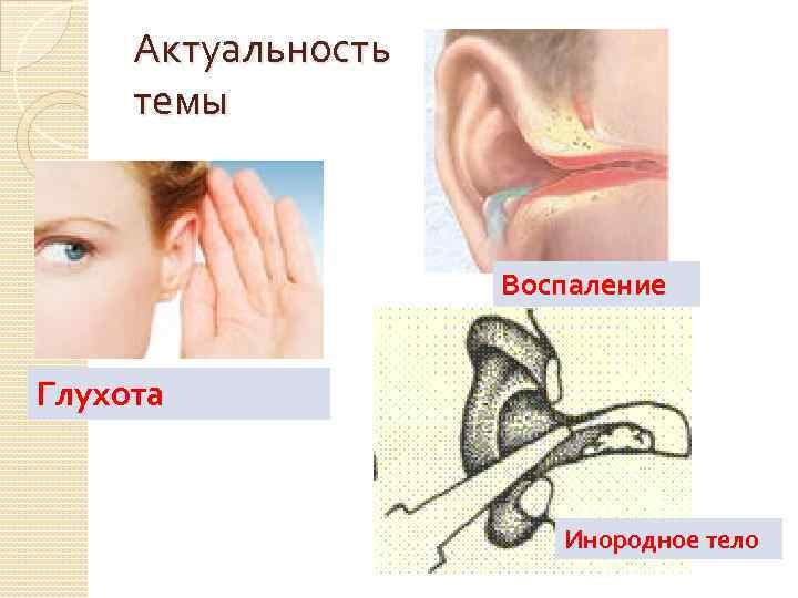 Актуальность темы Воспаление Глухота Инородное тело 