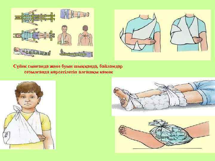 Сүйек сынғанда және буын шыққанда, байламдар созылғанда көрсетілетін алғашқы көмек 