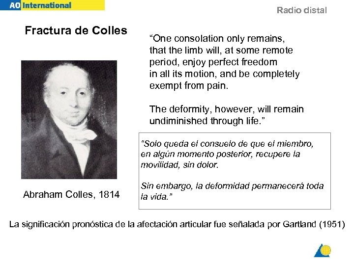 Radio distal Fractura de Colles “One consolation only remains, that the limb will, at