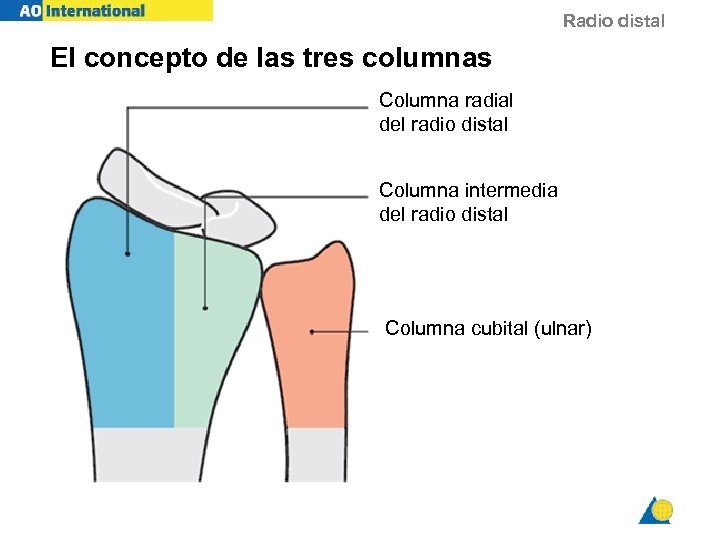 Radio distal El concepto de las tres columnas Columna radial del radio distal Columna