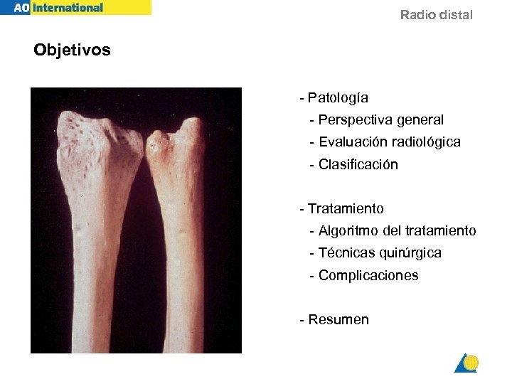 Radio distal Objetivos - Patología - Perspectiva general - Evaluación radiológica - Clasificación -