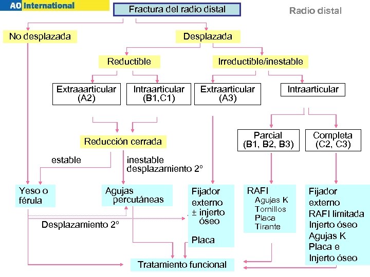 Fractura del radio distal No desplazada Desplazada Irreductible/inestable Reductible Extraaarticular (A 2) Intraarticular (B