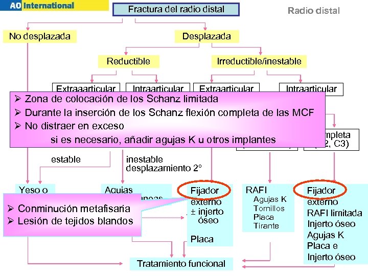 Fractura del radio distal No desplazada Radio distal Desplazada Irreductible/inestable Reductible Extraaarticular Intraarticular Extraarticular