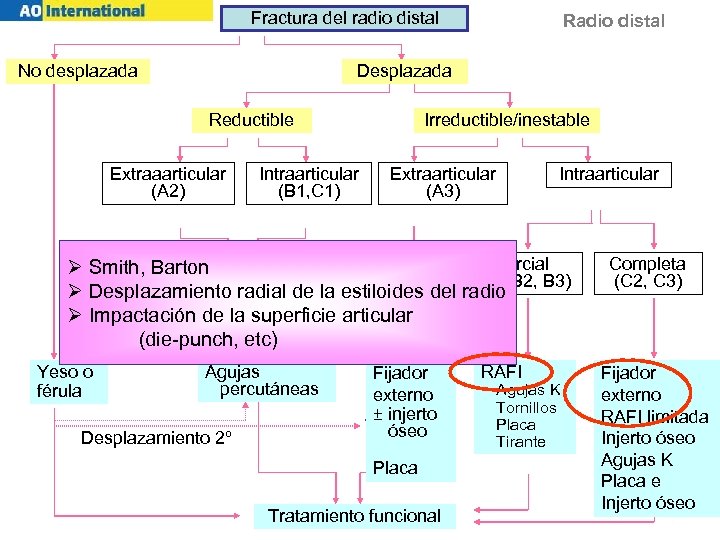 Fractura del radio distal No desplazada Radio distal Desplazada Irreductible/inestable Reductible Extraaarticular (A 2)