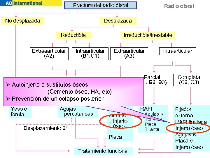 Fractura del radio distal No desplazada Desplazada Irreductible/inestable Reductible Extraaarticular (A 2) Intraarticular (B