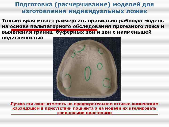 Подготовка (расчерчивание) моделей для изготовления индивидуальных ложек Только врач может расчертить правильно рабочую модель
