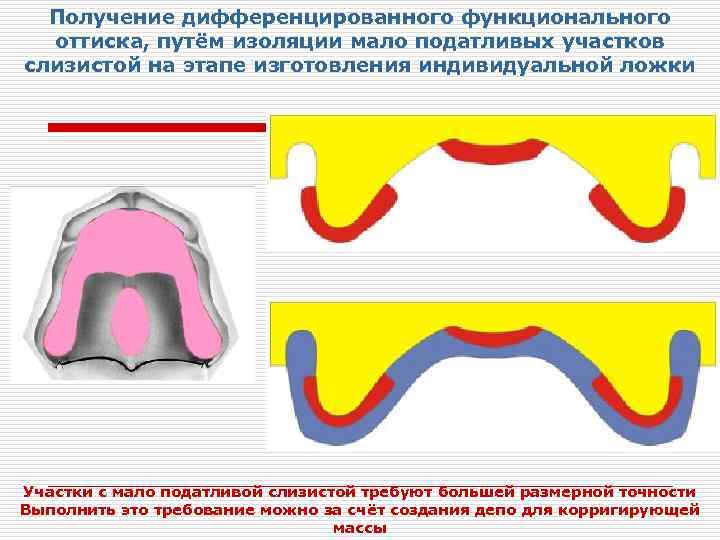 Зона податливости слизистой оболочки