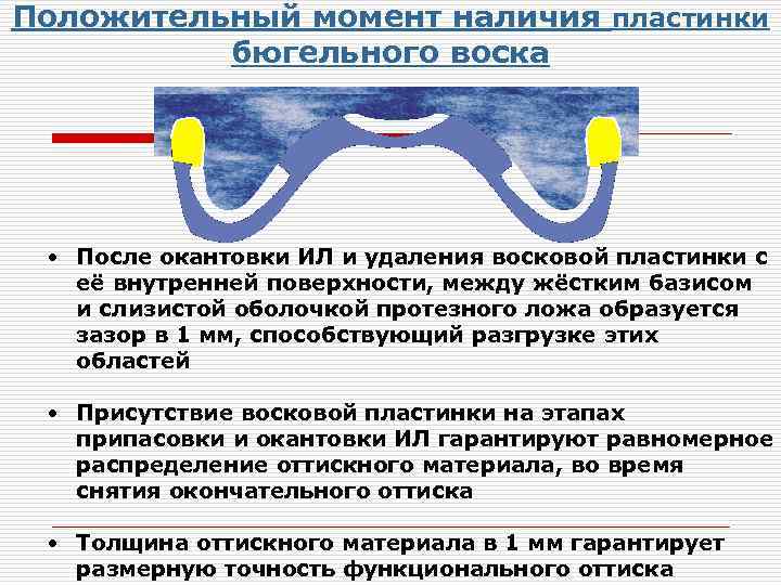 Протезное поле и протезное ложе. Окантовка индивидуальной ложки воском. Пластинки для индивидуальных ложек. Окантовка функционального оттиска. Воск окантовочный для индивидуальных ложек.