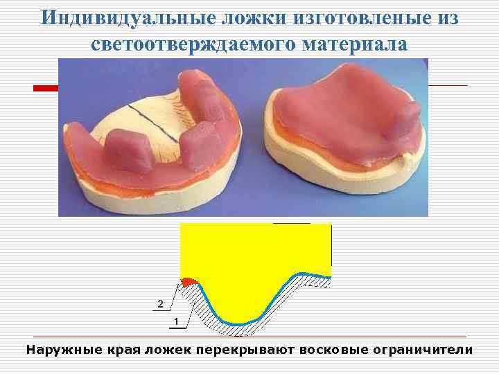 Индивидуальные ложки в ортопедической стоматологии презентация