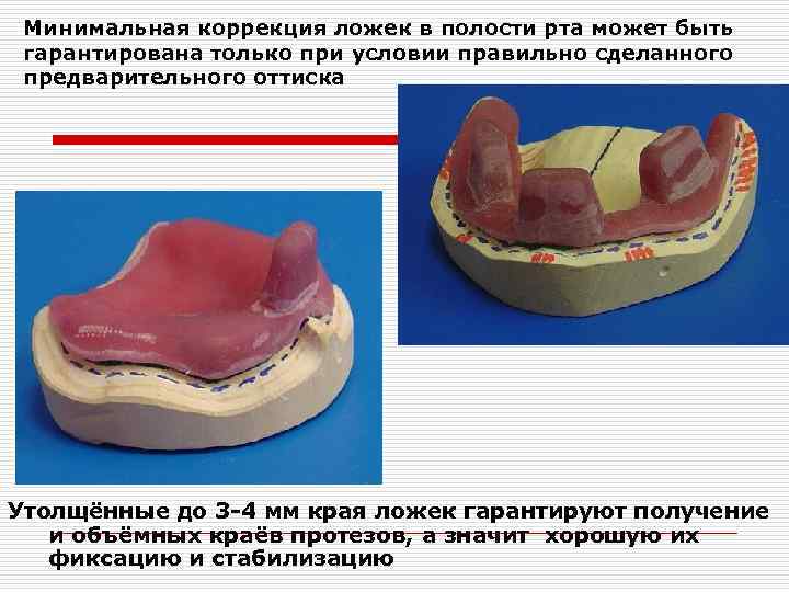 Сделать индивидуальную. Индивидуальная ложка. Индивидуальная ложка на верхнюю челюсть. Границы индивидуальной ложки. Индивидуальная ложка на верхнюю челюсть и нижнюю.