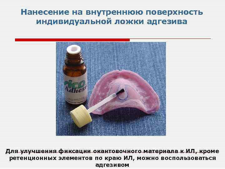 Нанесение на внутреннюю поверхность индивидуальной ложки адгезива Для улучшения фиксации окантовочного материала к ИЛ,