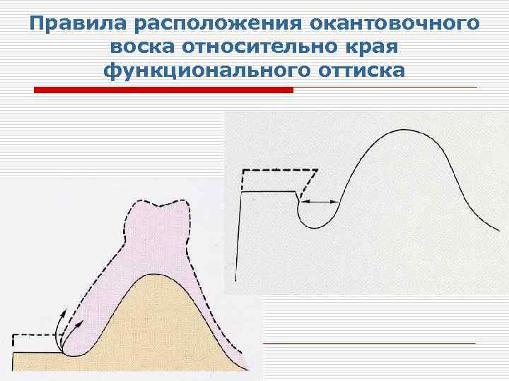 Правила расположения окантовочного воска относительно края функционального оттиска 