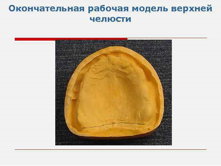 Окончательная рабочая модель верхней челюсти 