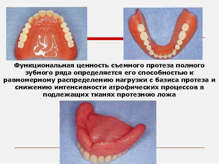 Протезное поле и протезное ложе. Реакция тканей протезного ложа на полные съемные протезы. Толщина базиса съемного протеза. Границы базиса полного съемного протеза.