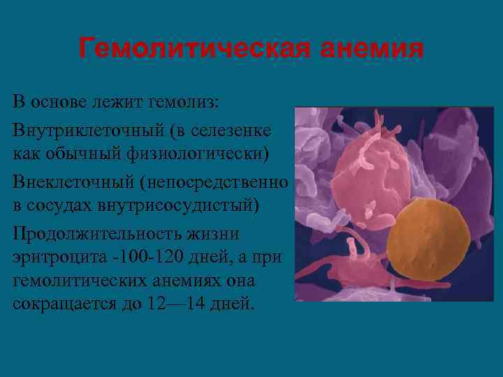 Гемолитическая анемия В основе лежит гемолиз: Внутриклеточный (в селезенке как обычный физиологически) Внеклеточный (непосредственно