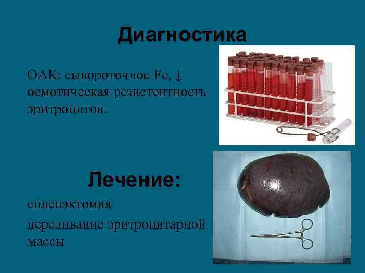 Диагностика ОАК: сывороточное Fе, ↓ осмотическая резистентность эритроцитов. Лечение: спленэктомия переливание эритроцитарной массы 