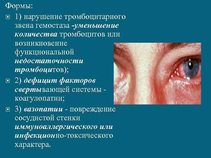 Формы: 1) нарушение тромбоцитарного звена гемостаза -уменьшение количества тромбоцитов или возникновение функциональной недостаточности тромбоцитов);