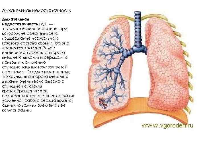 Дыхательная недостаточность (ДН) — патологическое состояние, при котором не обеспечивается поддержание нормального газового состава