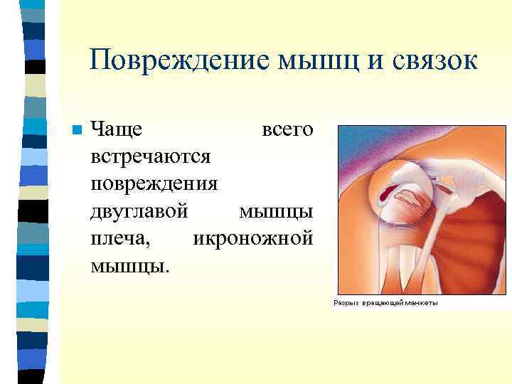 Повреждение мышц и связок n Чаще всего встречаются повреждения двуглавой мышцы плеча, икроножной мышцы.