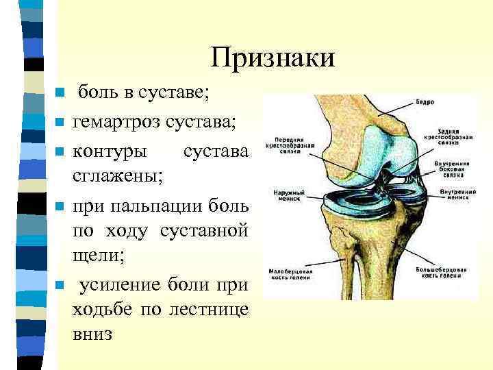Признаки n n n боль в суставе; гемартроз сустава; контуры сустава сглажены; при пальпации