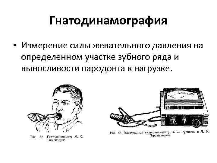 Гнатодинамография • Измерение силы жевательного давления на определенном участке зубного ряда и выносливости пародонта