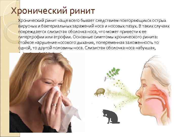 Хронический ринит чаще всего бывает следствием повторяющихся острых вирусных и бактериальных заражений носа и