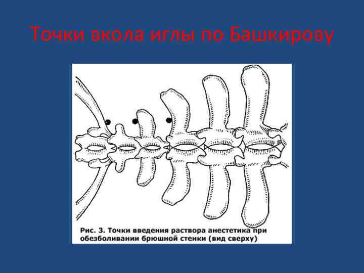 Точки вкола иглы по Башкирову 