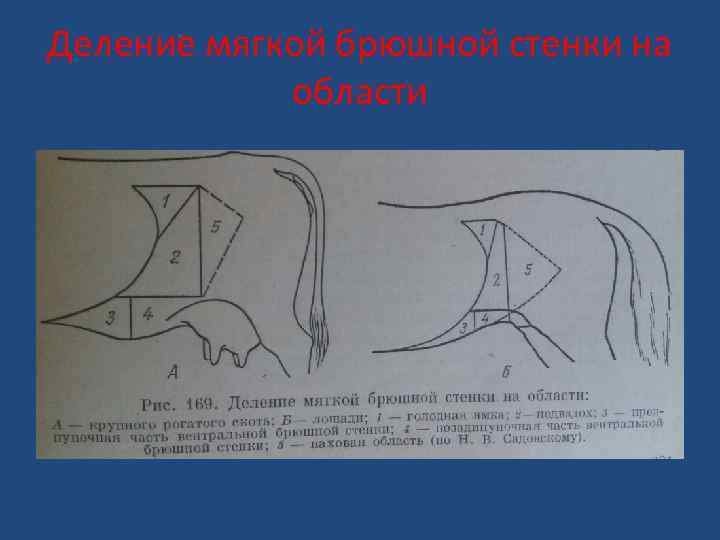 Деление мягкой брюшной стенки на области 