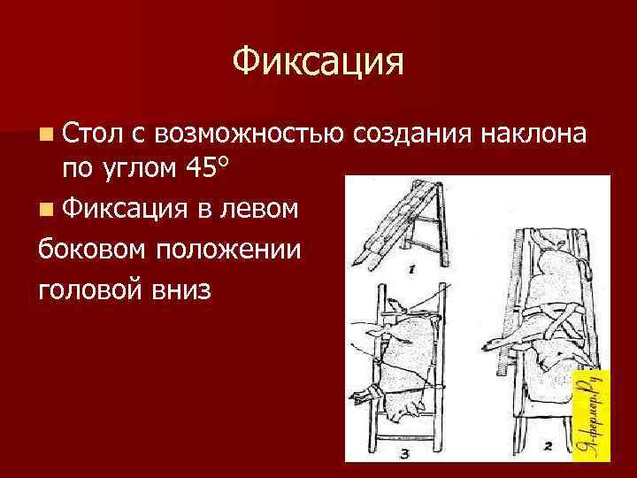 Фиксация n Стол с возможностью создания наклона по углом 45° n Фиксация в левом