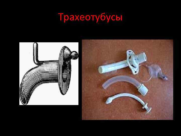 Трахеотубусы 