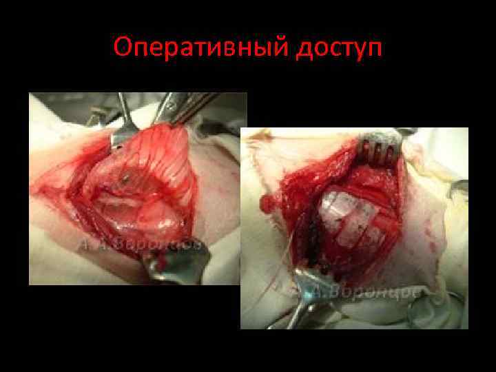 Оперативный доступ 