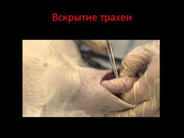 Вскрытие трахеи 
