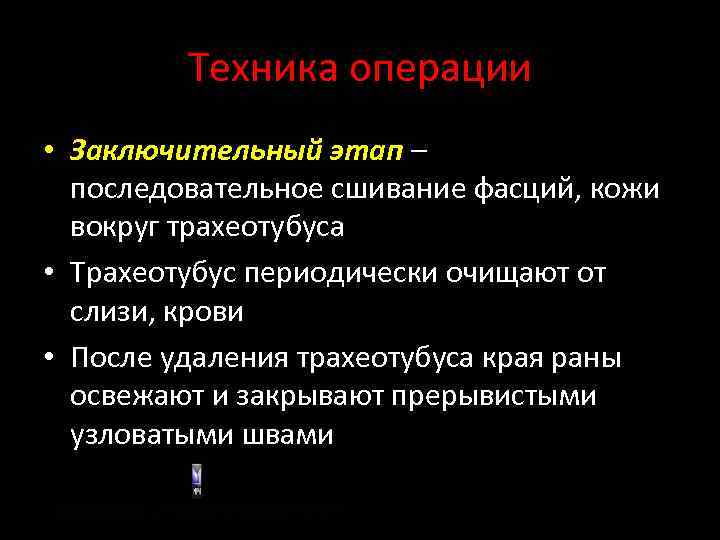 Техника операции • Заключительный этап – последовательное сшивание фасций, кожи вокруг трахеотубуса • Трахеотубус