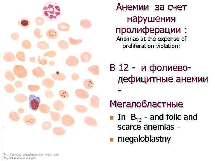 Анемии за счет нарушения пролиферации : Anemias at the expense of proliferation violation: В