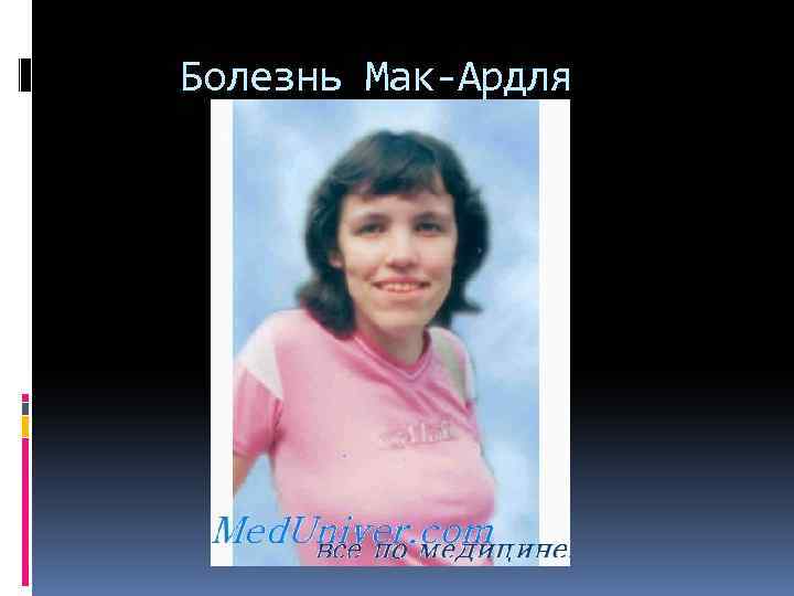 Болезнь Мак-Ардля 