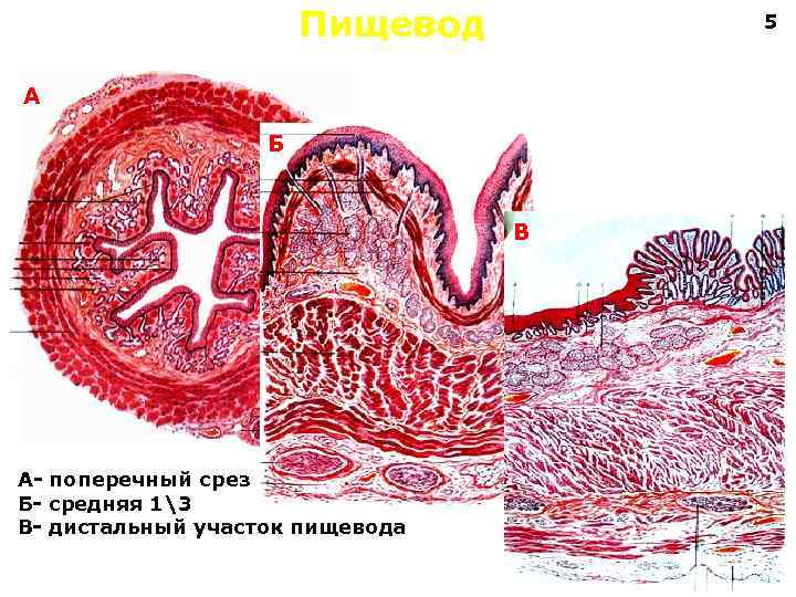 Пищевод 5 А Б В А- поперечный срез Б- средняя 13 В- дистальный участок