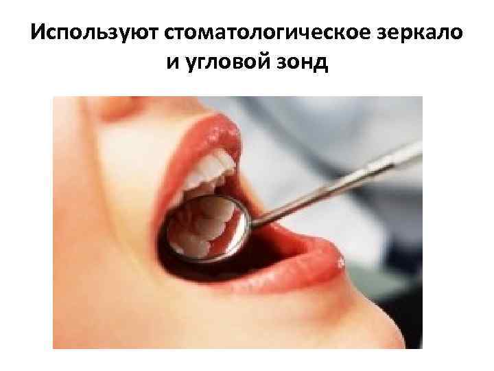 Используют стоматологическое зеркало и угловой зонд 