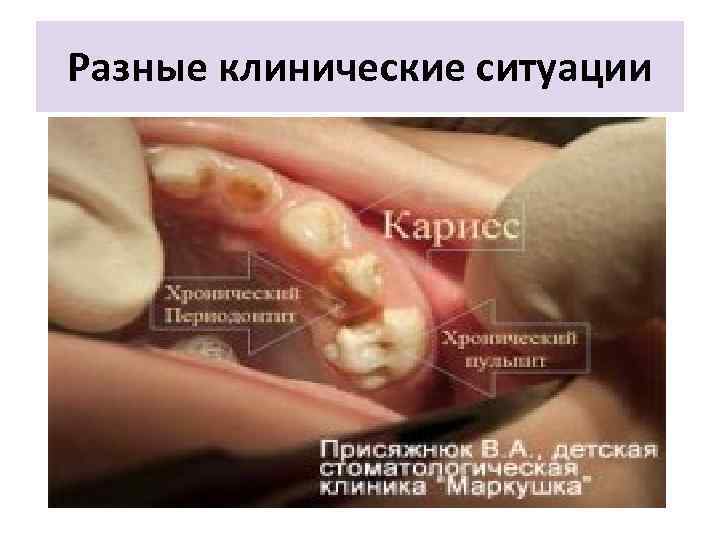 Разные клинические ситуации 