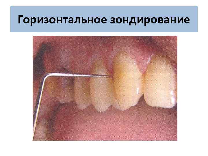 Горизонтальное зондирование 