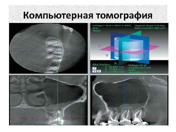 Компьютерная томография 