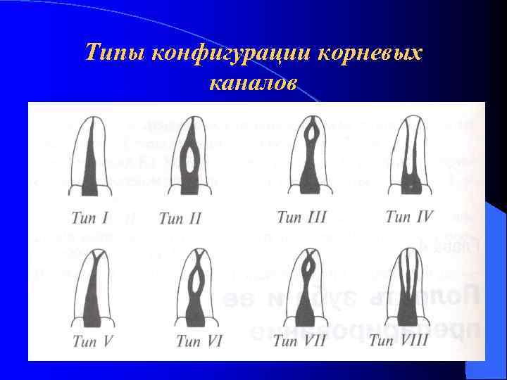 Схема корневых каналов