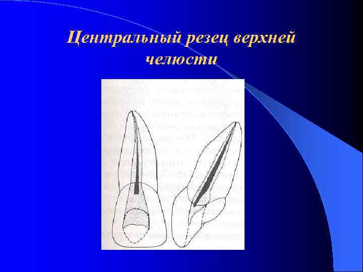 Центральный резец верхней челюсти 