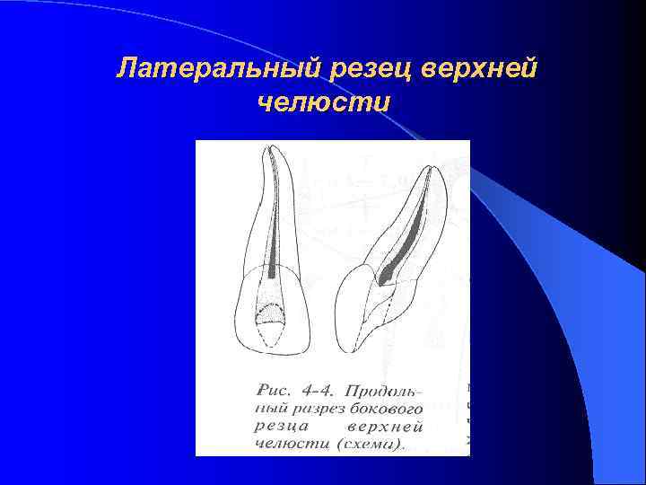 Латеральный резец верхней челюсти 