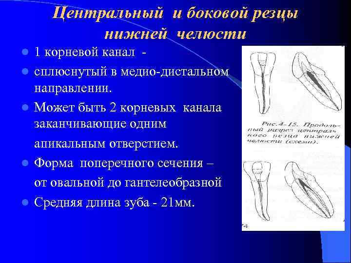 Центральный и боковой резцы нижней челюсти l l l 1 корневой канал сплюснутый в