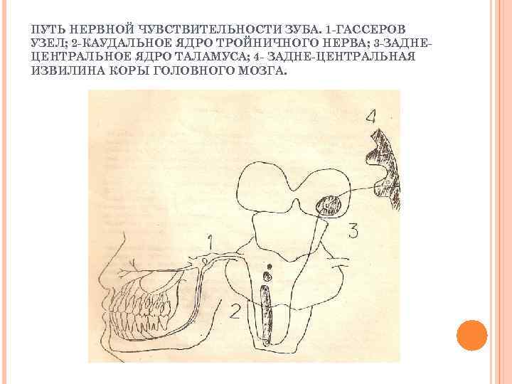 ПУТЬ НЕРВНОЙ ЧУВСТВИТЕЛЬНОСТИ ЗУБА. 1 -ГАССЕРОВ УЗЕЛ; 2 -КАУДАЛЬНОЕ ЯДРО ТРОЙНИЧНОГО НЕРВА; 3 -ЗАДНЕЦЕНТРАЛЬНОЕ