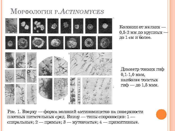 МОРФОЛОГИЯ Р. ACTINOMYCES Колонии от мелких — 0, 5 -2 мм до крупных —