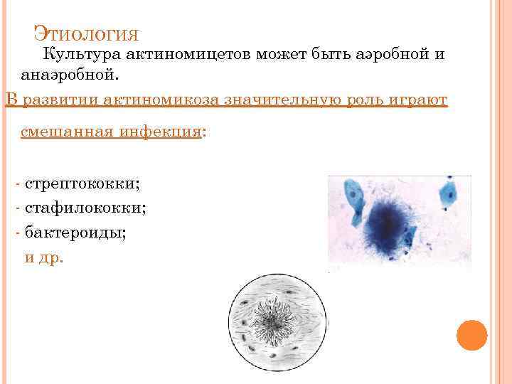 ЭТИОЛОГИЯ Культура актиномицетов может быть аэробной и анаэробной. В развитии актиномикоза значительную роль играют