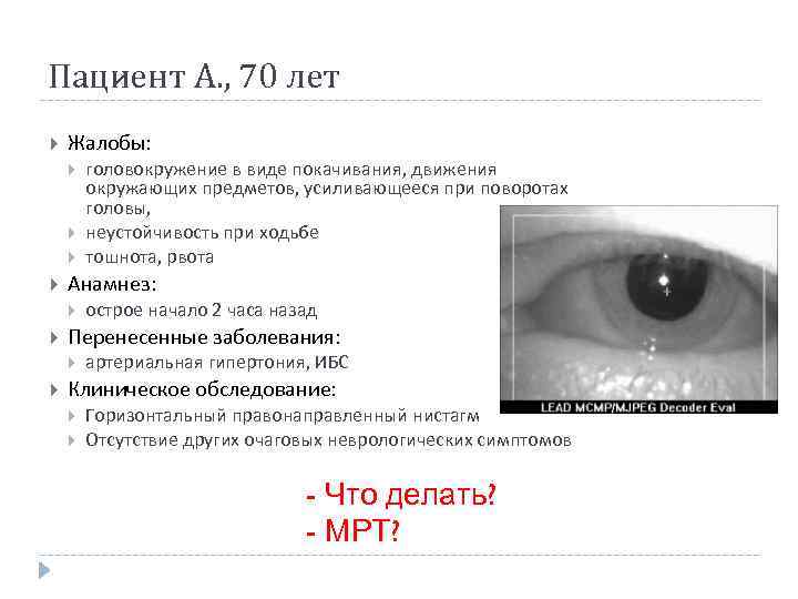 Пациент А. , 70 лет Жалобы: Анамнез: острое начало 2 часа назад Перенесенные заболевания: