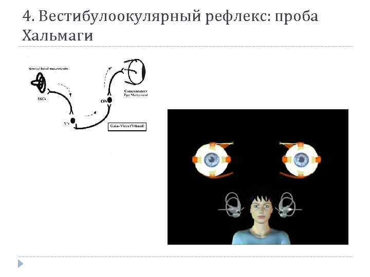 4. Вестибулоокулярный рефлекс: проба Хальмаги 